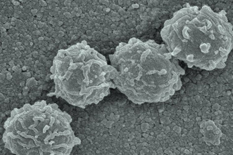 Capture Black mold spores are captured on the surface of the PECO filter.