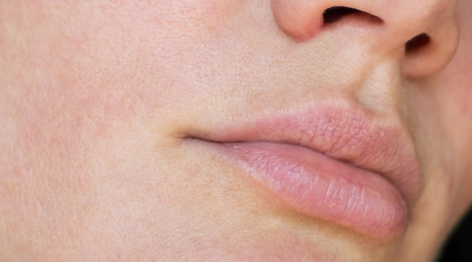 Winter Skin Wellness Tips