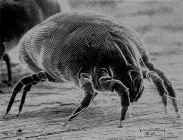 Dust Mites and Allergens with Dr. Parikh