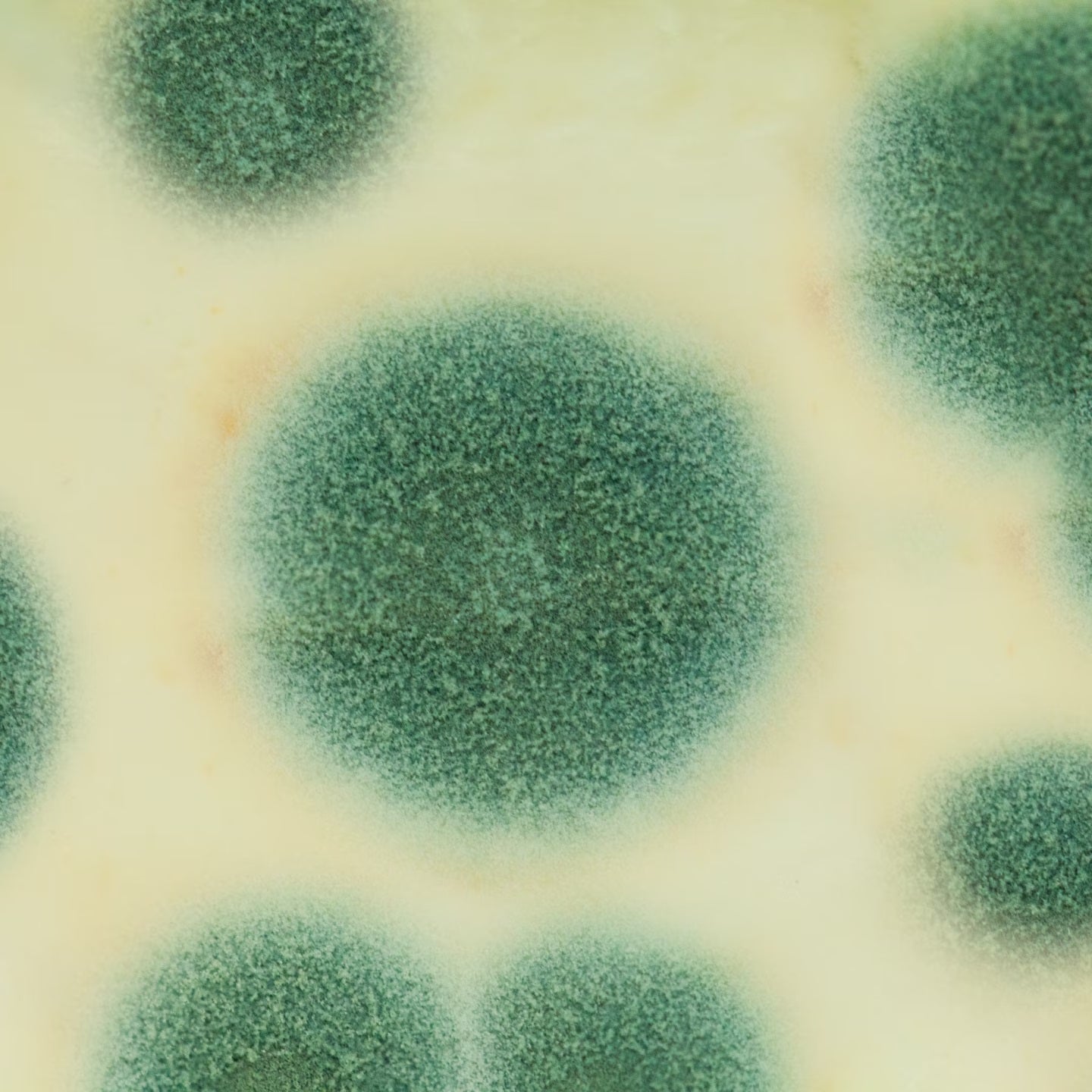 Mold spores under a microscope